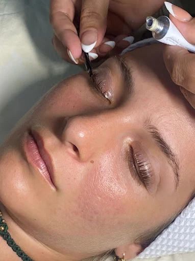 Professional Facial Treatment - Aurora Spa